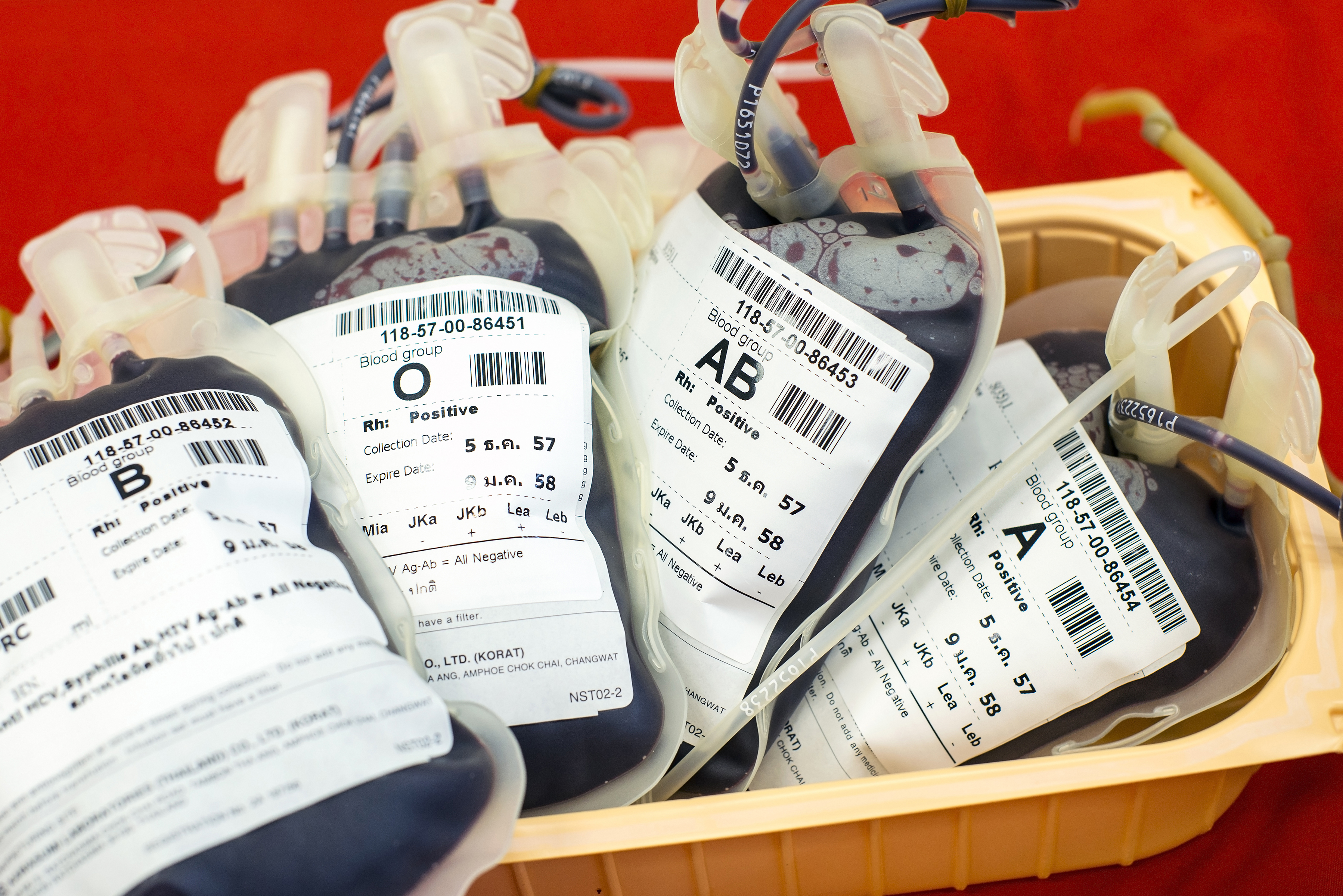 Этикетки группы. Этикетка для переливания крови. Группа крови фото. Лаборатория переливания крови.