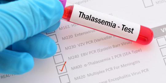 talassemia