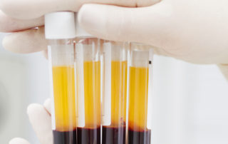 plasma coronavirus