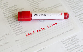 West Nile Virus