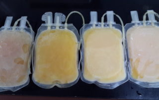 terapia al plasma