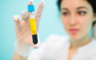 terapia al plasma iperimmune