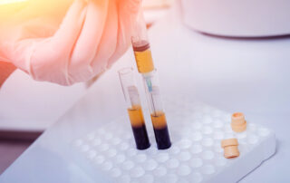 plasma iperimmune